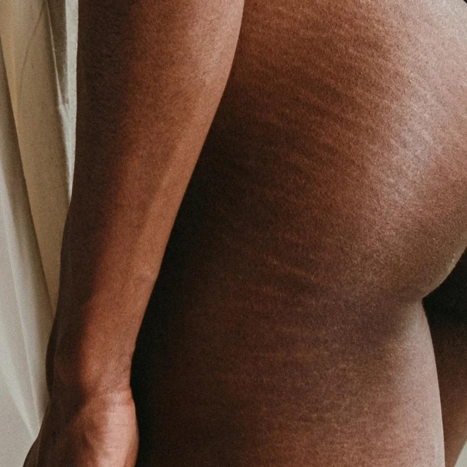 We Are Mammas – Výživný tělový olej proti striím